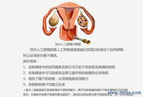 人工助孕技术优势解析及常见方法对比 人工助孕技术优势解析及常见方法对比